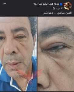 الفنان تامر ضيائي 